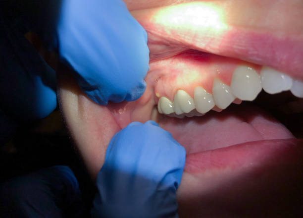 Best After-Hours Emergency Dentist in East Berwick, PA